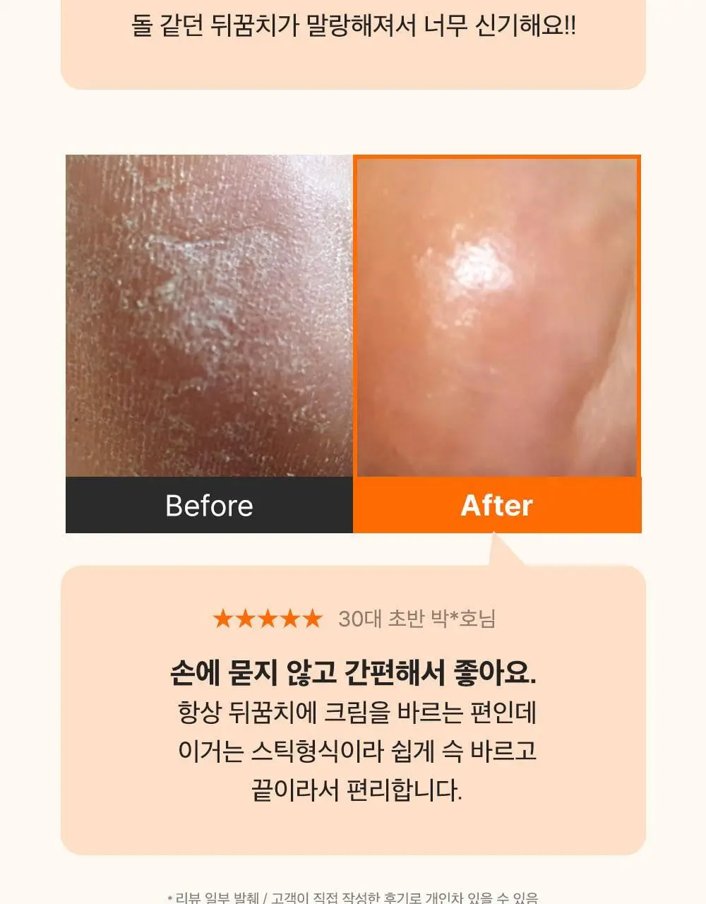 [데일리풋케어/맨들맨들아기발] 성분에디터 시어버터 베이비 풋 스틱 20g 2종 택 1 상세페이지 40